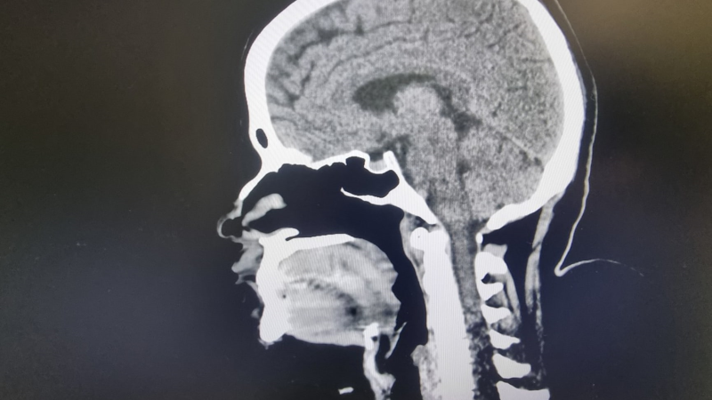 Jak se bránit „hnilobě mozku“? Vědci zkoumají nový fenomén spojený s prohlížením internetu