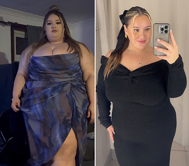 Vážila téměř 230 kilo a nezabraly ani injekce na hubnutí. Pomohla až operace